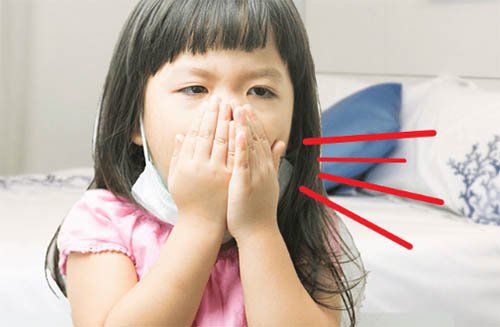 Trẻ thường xuyên bị ho và sổ mũi phải làm sao?