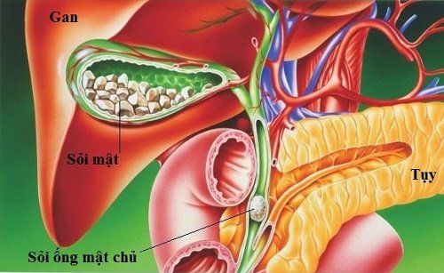 Warning symptoms of common bile duct stones