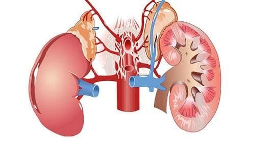 Symptoms of chronic kidney failure are often silent, not obvious