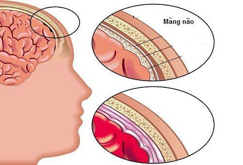 
Đái dầm nhiều sẽ có nhiều nguy hiểm cho trẻ
