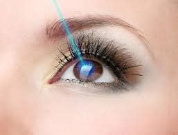 
Một số trường hợp khác có thể sử dụng kỹ thuật phẫu thuật hiện đại như Lasik
