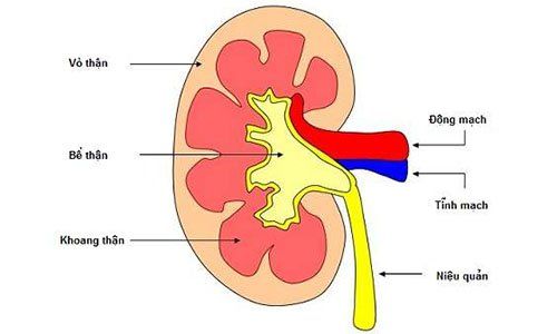 
Viêm cầu thận cấp là một bệnh lý gây tổn thương thận cấp tính
