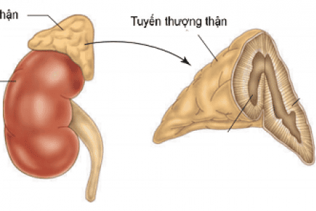 Causes of benign adrenal tumors