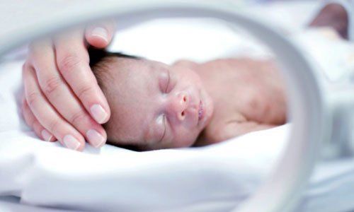 Treatment of patent ductus arteriosus in premature infants