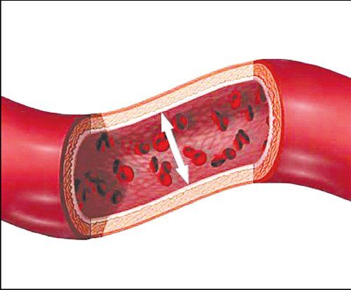 Huyết Áp Là Lực Co Bóp Của Tim: Tìm Hiểu Sâu Về Chỉ Số Sức Khỏe Quan Trọng