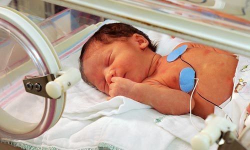 Surfactant pump for neonatal respiratory failure: Things to note