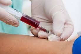 Xét nghiệm máu bình thường có phát hiện ra HIV?