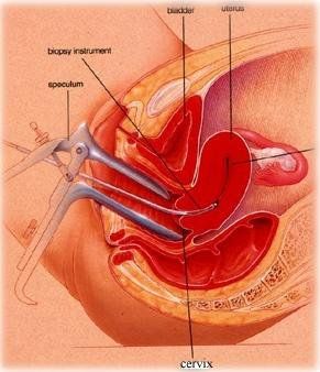 
Thời điểm sinh thiết: ngày 21 – 24 của chu kỳ kinh nguyệt
