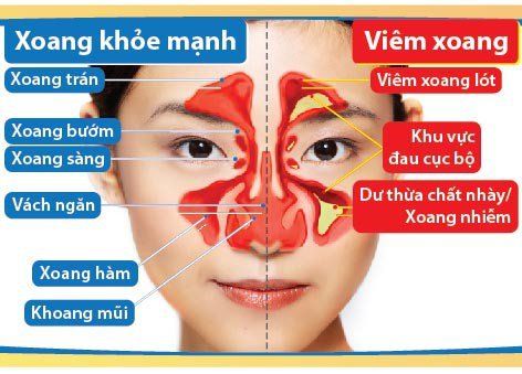 
Cấu tạo giải phẫu của Xoang
