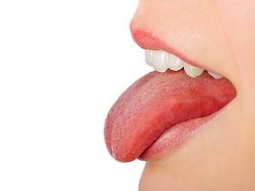 Early signs of tongue cancer