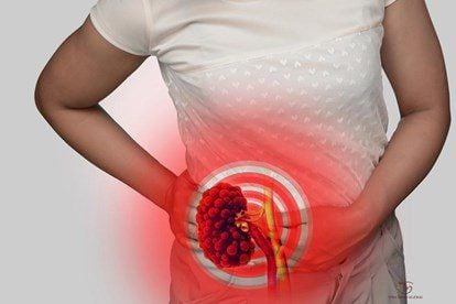 Causes of chronic kidney failure