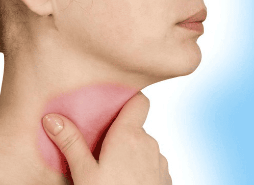 Có nhiều yếu tố nguy cơ viêm họng gây ù tai hay đau đầu.