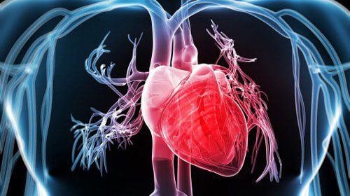 Coronary angiography at Vinmec: Instructions before - during - after the scan