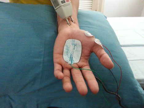 What is electromyography (EMG) for?