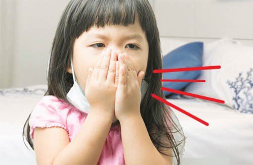 The virus that causes bronchiolitis in children