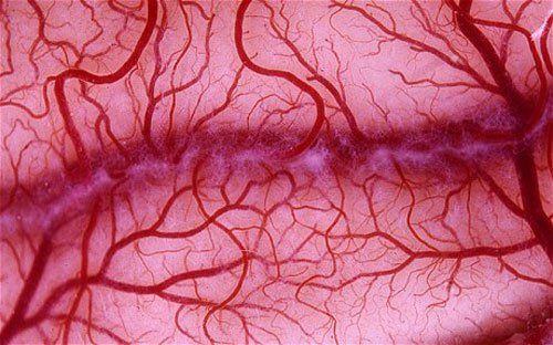 What is vascular proliferation?