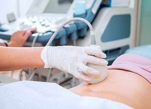 The role of fetal Doppler ultrasound