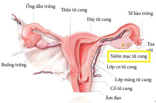 
Niêm mạc tử cung hay nội mạc tử cung là lớp mô tế bào phủ toàn bộ mặt trong của tử cung ở phụ nữ
