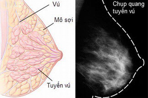 
U sợi có nguồn gốc từ các cấu trúc cơ thượng mô nằm lân cận các ống sữa bên ngoài các tiểu thùy
