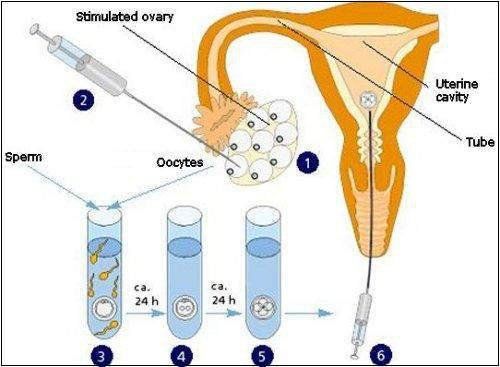Methods to stimulate ovulation