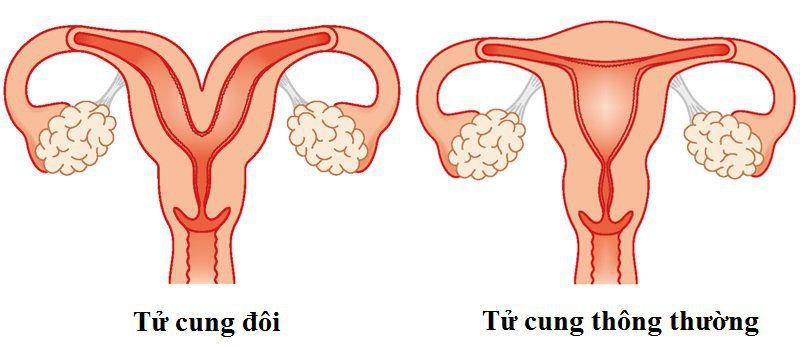 4. Sự thay đổi của tử cung qua các giai đoạn