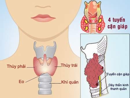 Possible effects after thyroidectomy