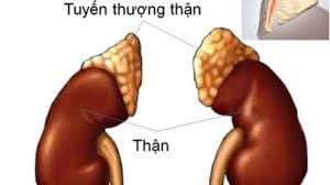 
U tủy thượng thận là một khối u hiếm gặp của tuyến thượng thận
