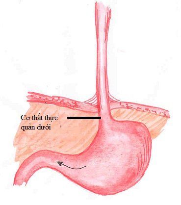 
Co thắt tâm vị gây khó khăn cho thực phẩm và chất lỏng trong việc lưu thông xuống dạ dày
