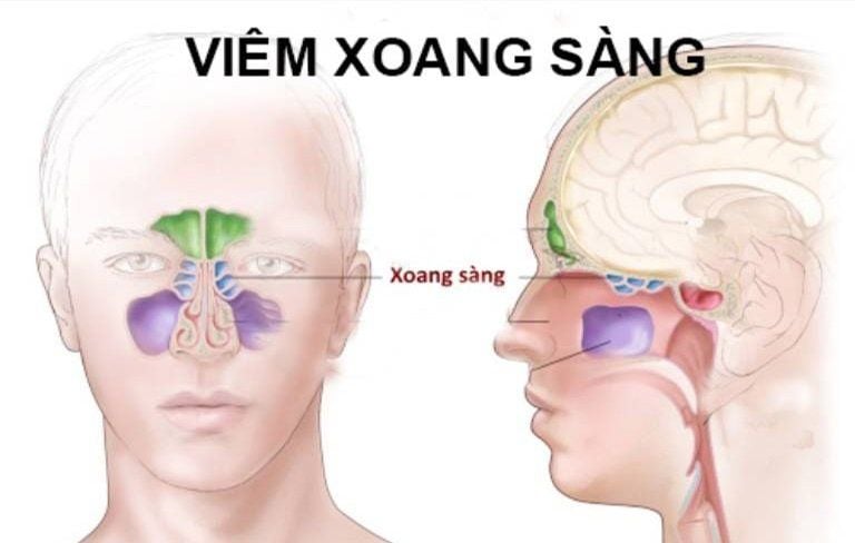 Chống Chỉ Định và Thận Trọng Khi Sử Dụng