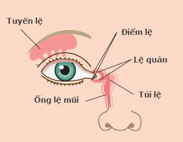 Tracheal obstruction and its signs