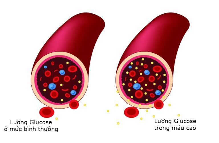 Các Phương Pháp Định Lượng Glucose Máu