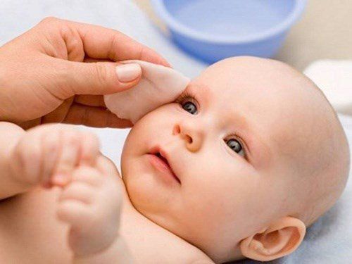 
Live tears due to blocked lacrimal ducts make the baby's eyes always 