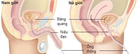 
Hình ảnh mô tả kỹ thuật thông tiểu
