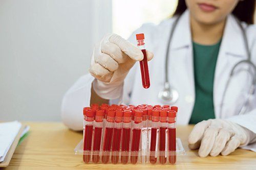 CO2 (carbon dioxide) test