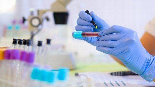 Lipase test in the diagnosis of pancreatic diseases