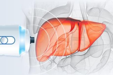 
Fibroscan đo độ đàn hồi gan là một phương pháp siêu âm mới, được sử dụng để đánh giá mức độ xơ gan
