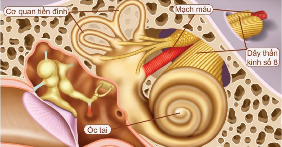 IV. Chẩn Đoán U Dây Thần Kinh Số 8