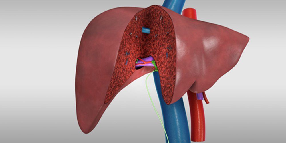 Laparoscopic Liver Resection What You Need To Know Vinmec