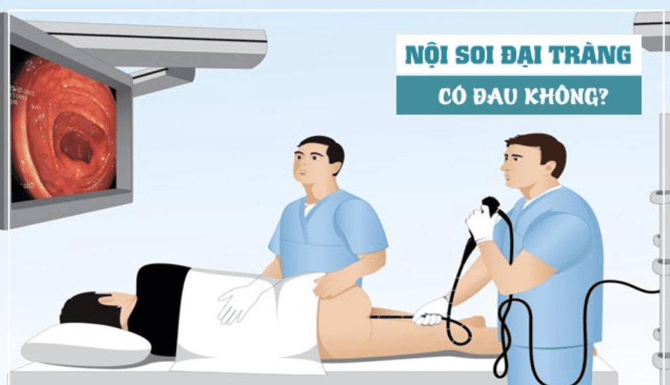 Nội soi trực tràng có đau không? Khám phá sự thật và trải nghiệm an toàn