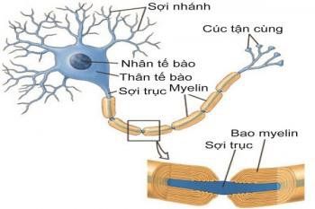 
Nguyên nhân gây ra bệnh CIDP là bởi viêm dây thần kinh và rễ thần kinh
