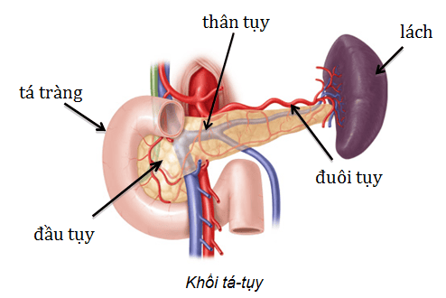 Mổ nội soi cắt thân và đuôi tụy