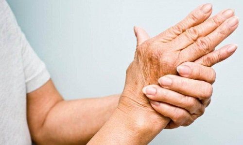 Rheumatoid arthritis is an autoimmune disease?