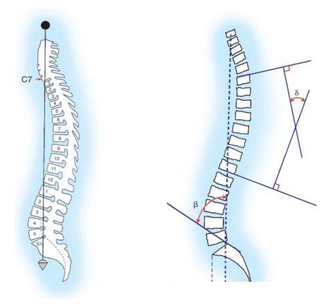 
Góc vẹo cột sống lưng cần đảm bảo yêu cầu kĩ thuật
