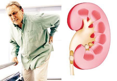 Diagnosis of anuria in patients with acute renal failure