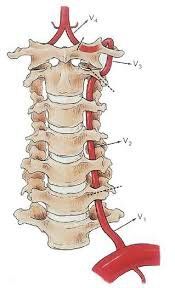 Vertebral vascular injury surgery