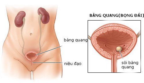 Rối loạn co bóp chức năng bàng quang là bệnh gì và điều trị thế nào?