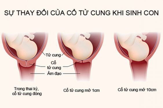 Tử cung mở 1cm: Dấu hiệu, thời điểm sinh và những điều cần lưu ý