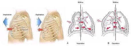 
Mảng sườn di động là tổn thương đặc trưng của chấn thương ngực gây gãy một loạt các xương sườn
