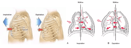 
Mảng sườn di động là tổn thương đặc trưng của chấn thương ngực gây gãy một loạt các xương sườn
