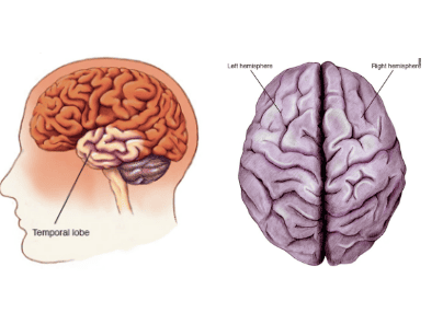 
Bệnh viêm não Nhật Bản có thể gây biến chứng động kinh
